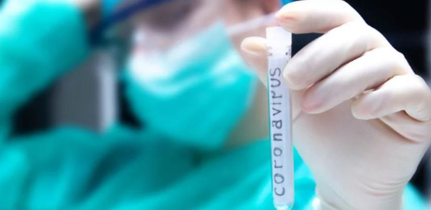 Informacije o upali pluća izazvanoj Corona virusom i savjeti SZO-a