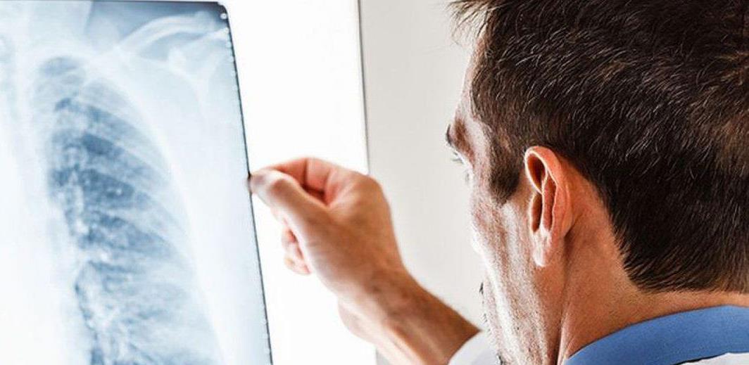 Doktori objavili novo istraživanje i upozorili: Covid ne uništava samo pluća