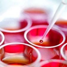 Ćelije pupčane vrpce po prvi put u srednjoj Evropi spasile život