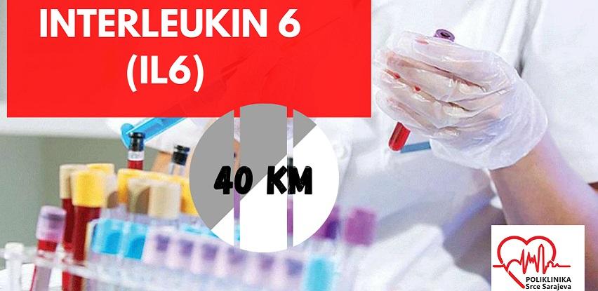 Poliklinika Srce Sarajeva laboratorijske usluge