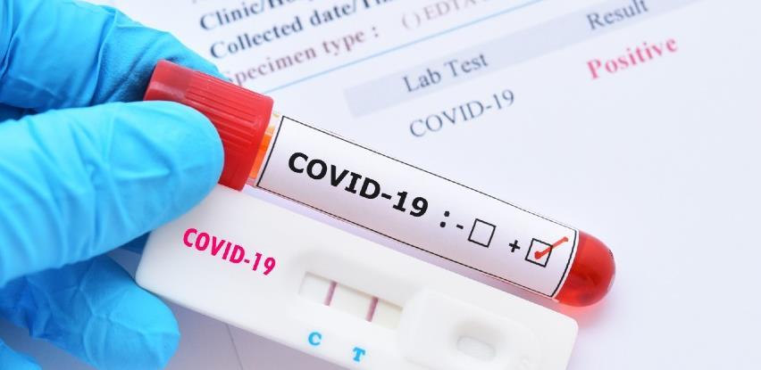 Badnjević: Testovi bh. laboratorija trebaju biti priznati ako su akreditovane