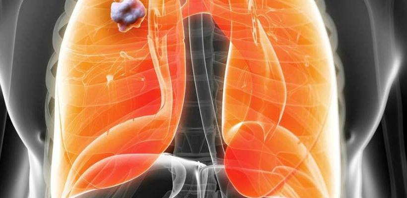 Ne propustite: Očistite pluća od katrana i toksina uz pomoć ovih namirnica