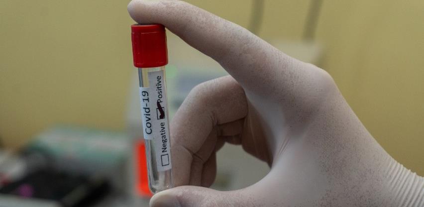 Šta je sa nabavkom lijekova za oboljele od Covida-19?