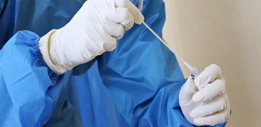 Antigenski testovi za brži skrining populacije