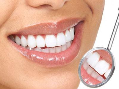 Četiri prirodna preparata za bijeljenje zuba