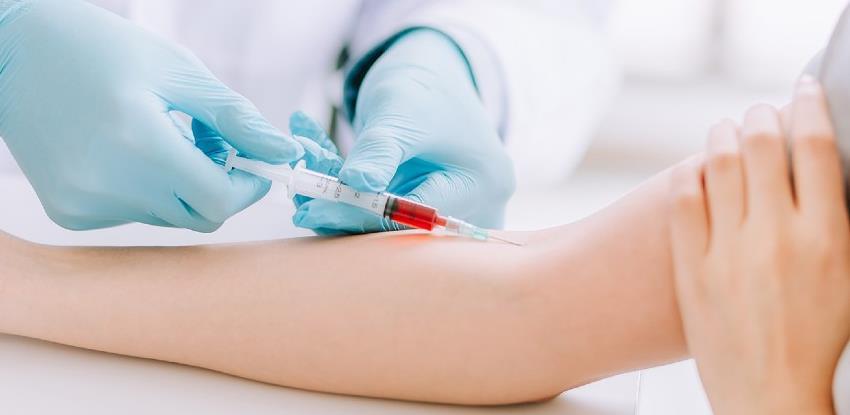 Srbija će do kraja aprila dobiti svoj serološki test