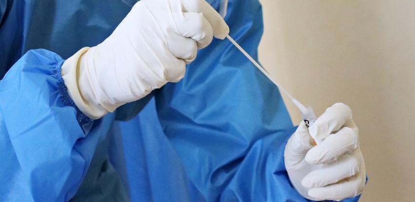 Jesu li brzi testovi prilika za ekonomiju?