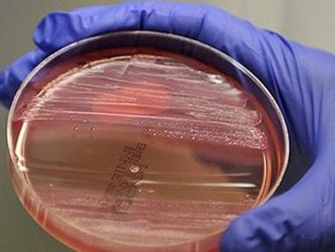 Agencija za sigurnost hrane prezentirala mikrobiološke kriterije za hranu