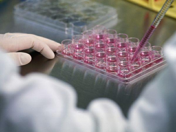 Matične ćelije pohranilo 3.500 porodica iz BiH