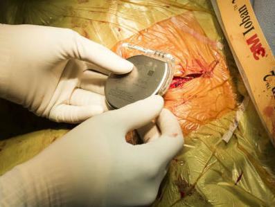 Stručnjaci: Moguće hakiranje pacemakera