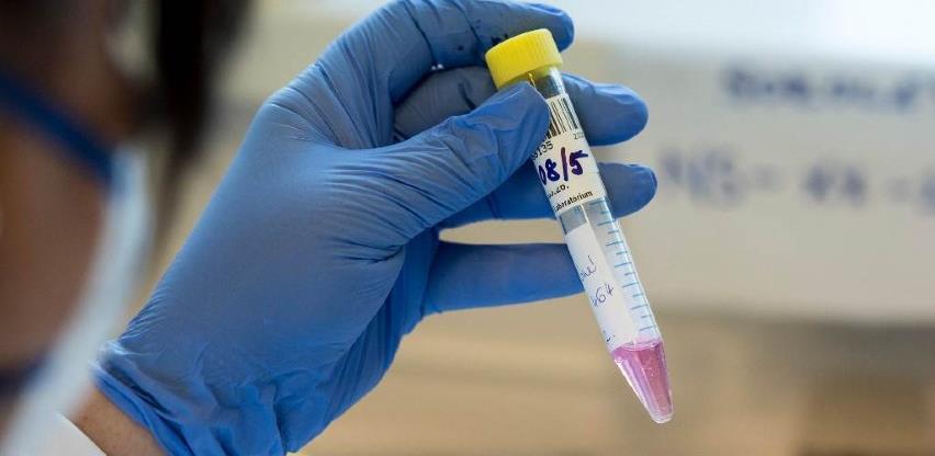 U BiH nijedna laboratorija nije akreditovana za testiranje na COVID-19
