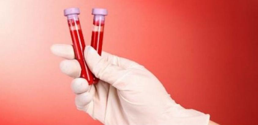 Ljudi s ovom krvnom grupom češće doživljavaju srčani udar