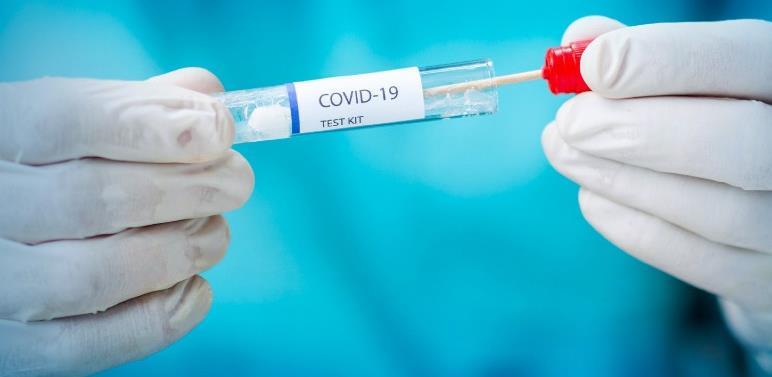 Slovenija mijenja prioritete za testiranja