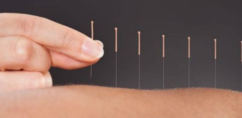 3. Seminar – osnove akupunkture