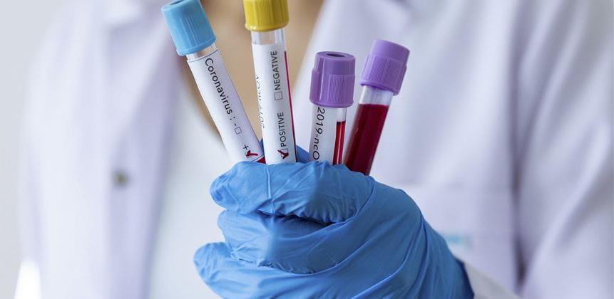 Sloveniju brine porast dnevnih zaraza u Hrvatskoj