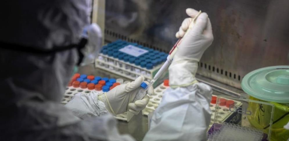 Sve o COVID-19 koronavirusu: Savjeti, pitanja i odgovori, mitovi i zablude