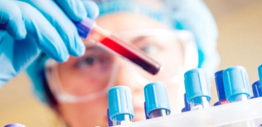 Zlatnu krvnu grupu ima nešto manje od 50 ljudi na cijelom svijetu