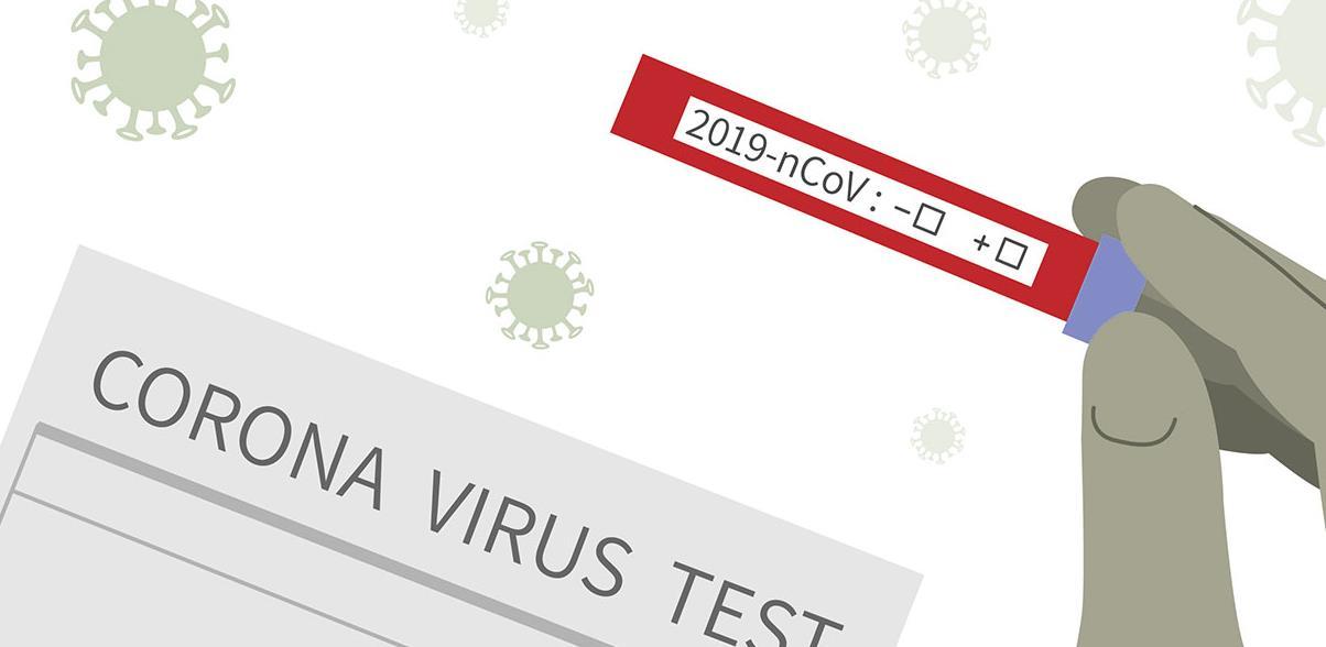 U Bosnu i Hercegovinu stiglo 150.000 testova iz Južne Koreje
