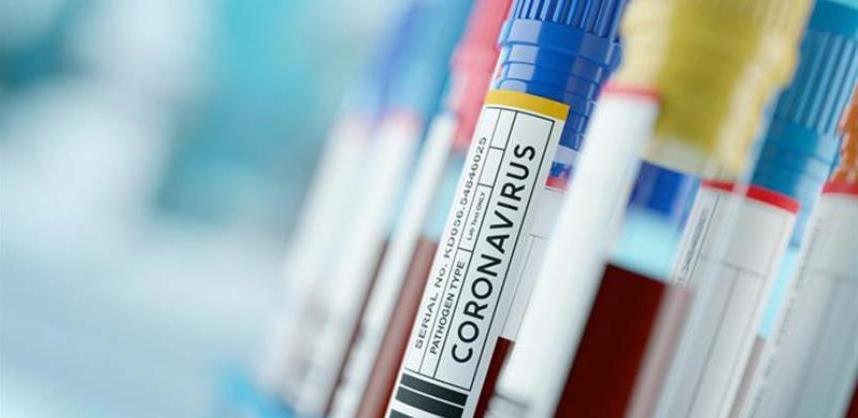 Konačno poznato: Erkona dobila posao od četiri miliona KM za nabavku testova