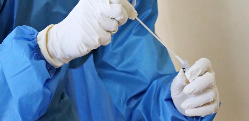 Kako da otkrijte jeste li već prebolovali covid-19