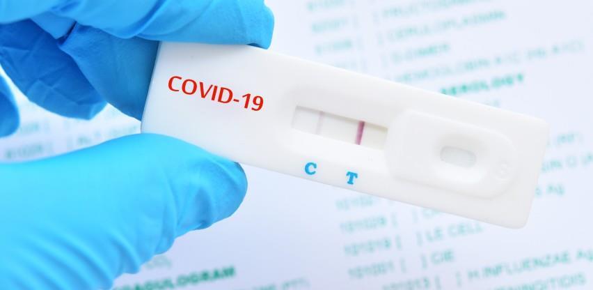 Evo kad ne treba obaviti PCR testiranje, jer nalaz može biti lažno negativan