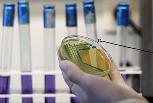 BiH nema u planovima FVO inspektora