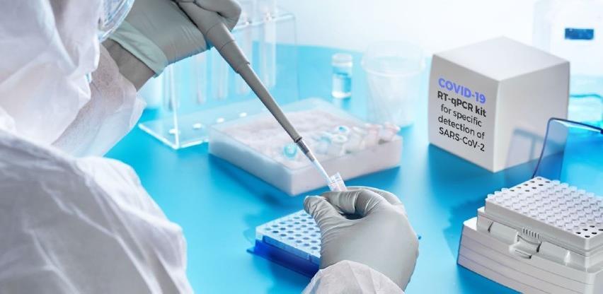 Tri privatne laboratorije vrše testiranje uzorka na koronu iz domova zdravlja KS