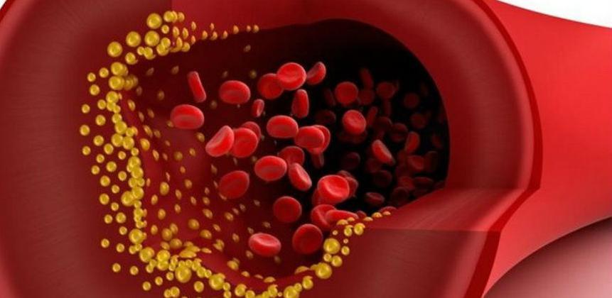 Holesterol ubrzava stvaranje tumora