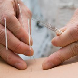 Alternativna medicina – prošlost ili budućnost?