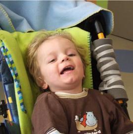 Zaokret u liječenju cerebralne paralize: Matične ćelije bude nadu