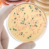 Što su aflatoksini?