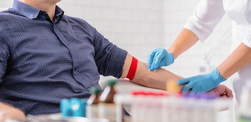 biomedicalab kućna posjeta vađenje krvi laboratorija