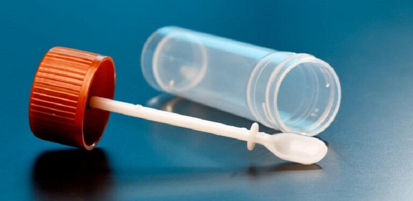 Fekalni kalprotektin Poliklinika Srce Sarajeva