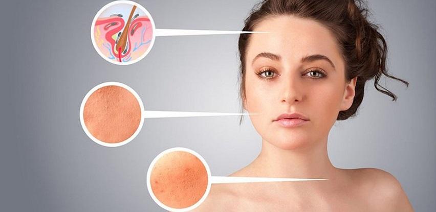 Demodex - čudovišta na licu!