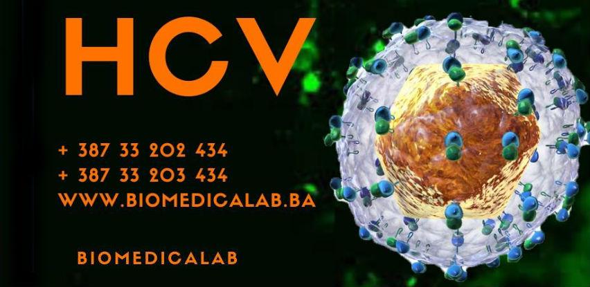 Testiranje na hepatitis C