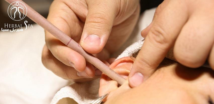 tretman svijećama za uši herbal spa