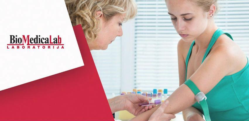 Iskoristite BioMedicaLab uslugu nalaz na kućna vrata!