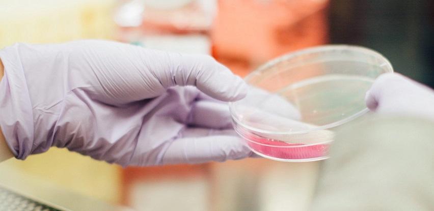streptokok brzi test streptococcus biomedicalab