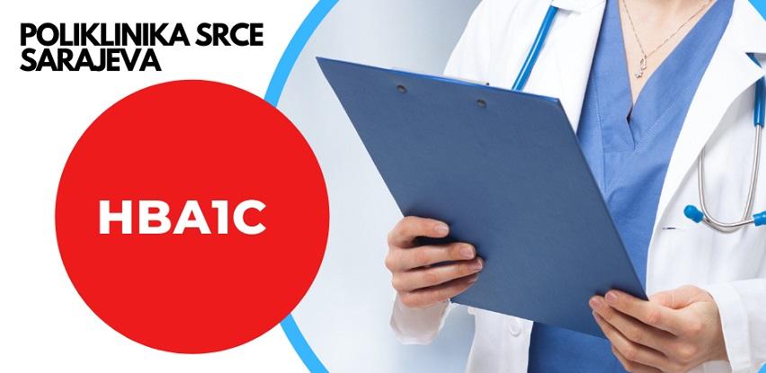 HbA1c test Poliklinika Srce Sarajeva