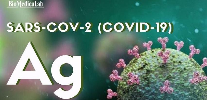 Nova cijena Antigen testa (Covid-19) u BioMedicaLab laboratoriji