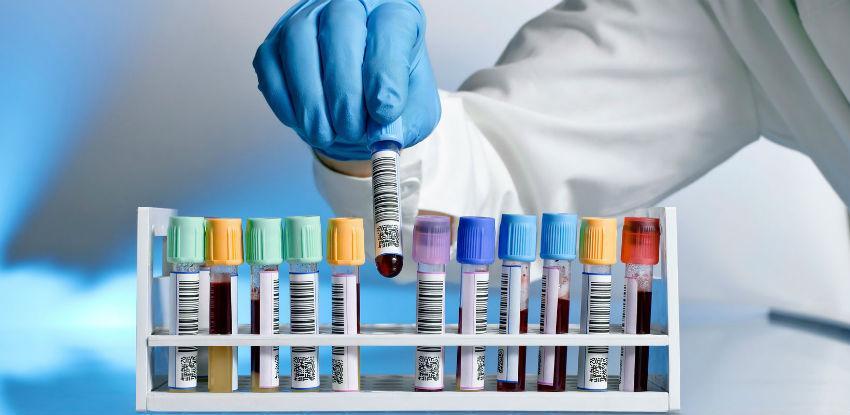 Akcijska ponuda laboratorijskih pretraga u Poliklinici Srce Sarajeva