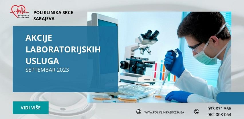 Poliklinika Srce Sarajeva laboratorijske usluge