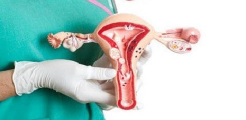 Tumor markeri AKCIJA