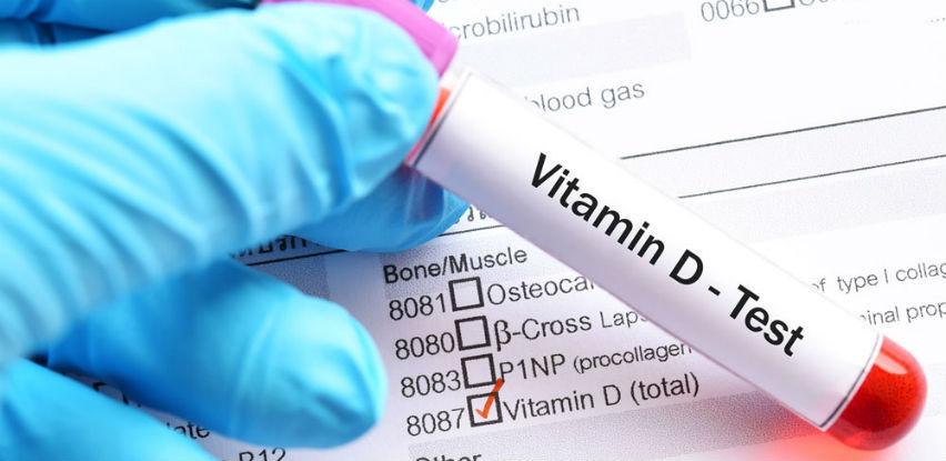 Provjerite imate li dovoljno Vitamina D