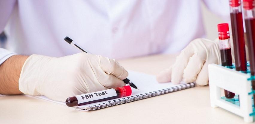 biomedicalab fsh folikularni stimulirajući hormon analiza