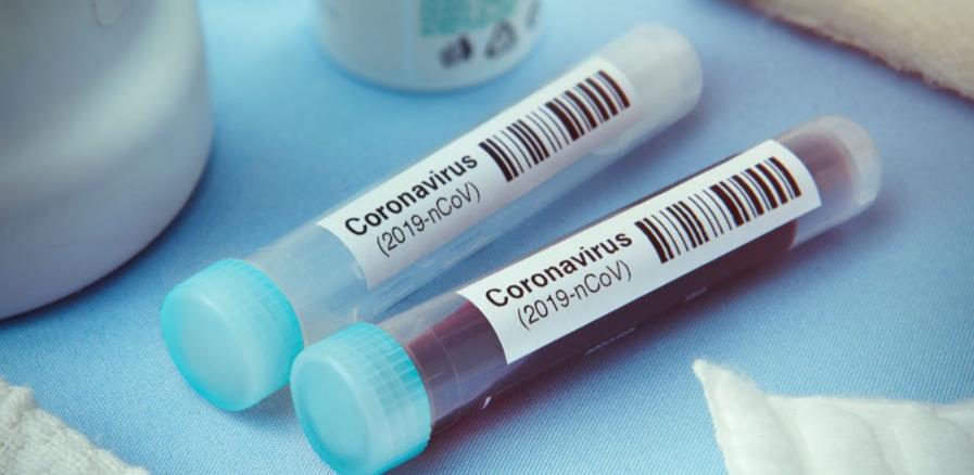 Erkona jedina mogla isporučiti 150.000 testova na koronavirus