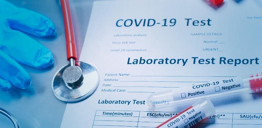 Postoji li test koji može otkriti i gripu i COVID-19?