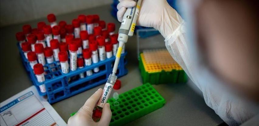 Privatne ambulante u RS-u ne mogu raditi testiranje PCR metodom
