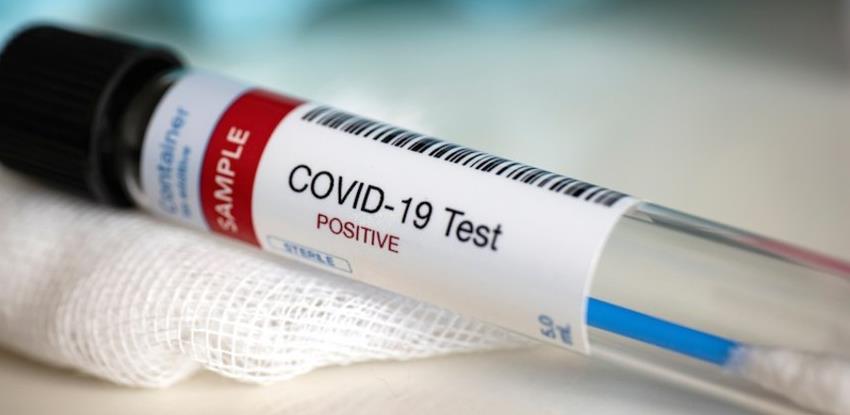 Donesen akt: U testiranje koronavirusa uključuju se i privatni laboratoriji