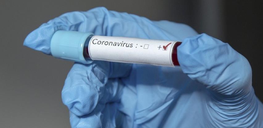 Testovi na virus korona u KS neće se čekati više po pet dana
